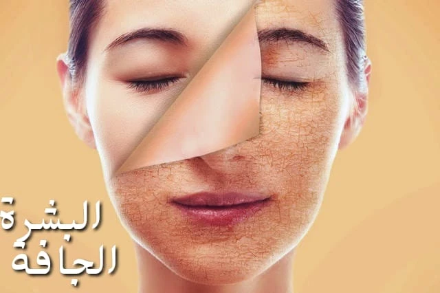 image about 14نوعًا من الأطعمة للمساعدة في حماية البشرة الجافة وترطيبها والعناية بها