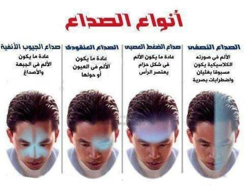 image about اسباب وانواع الصداع الراس وطرق علاجه