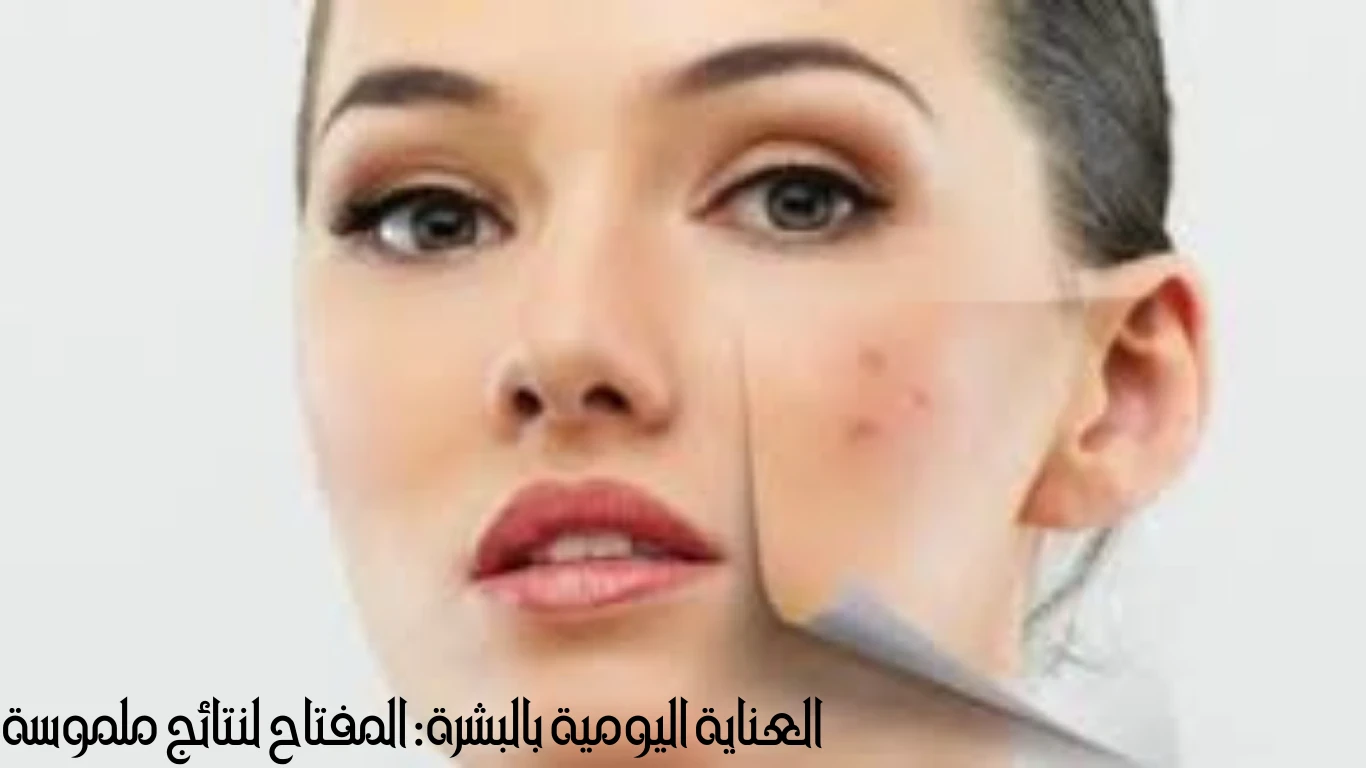 image about حب الشباب: التحدي الشائع والحلول الطبيعية