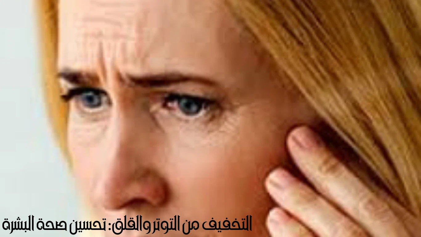 image about حب الشباب: التحدي الشائع والحلول الطبيعية