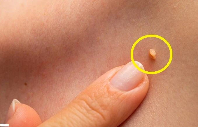 image about هذه العلامات الغير متوقعة تدل على أنك تنتظرين مولودا  ! 