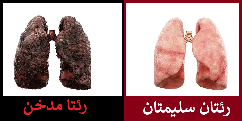 image about هبطل السجائر واكون انسان جديد و من ديسمبر الى يناير مش هدخن من جديد