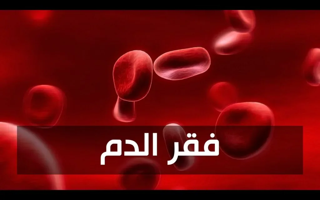 image about ماهو فقر الدم؟وماهي اسبابه وأعراضه ؟وهل لديه علاج؟