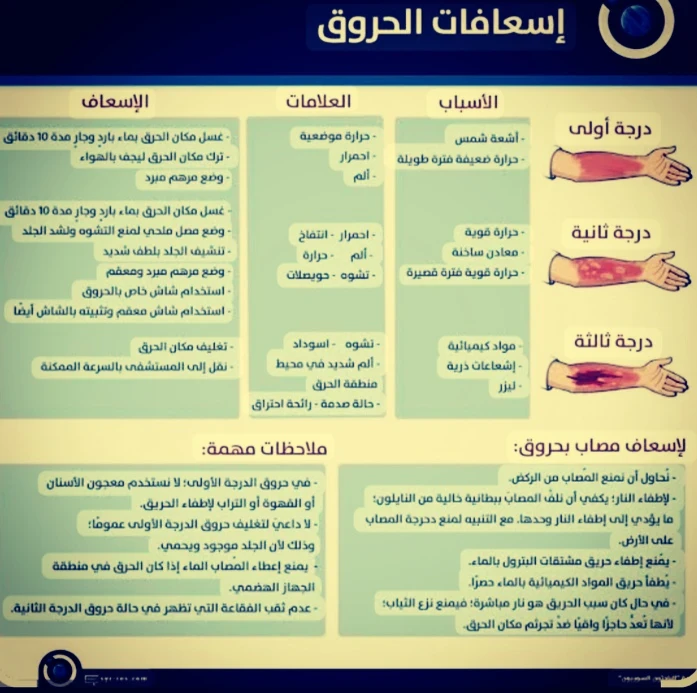 image about معلومات هامه عن الاسعافات  الأولية 