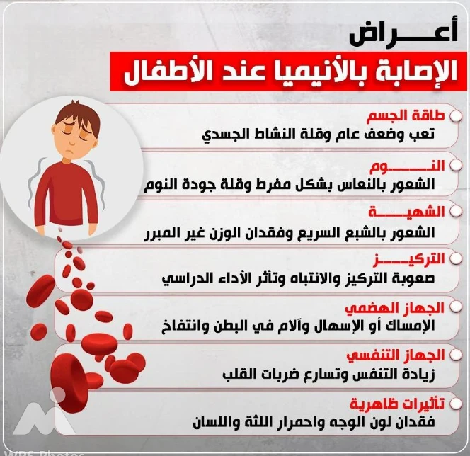 image about الأنيميا عند الأطفال: أعراضها، أسبابها، وحلول عملية لكل أم وأب