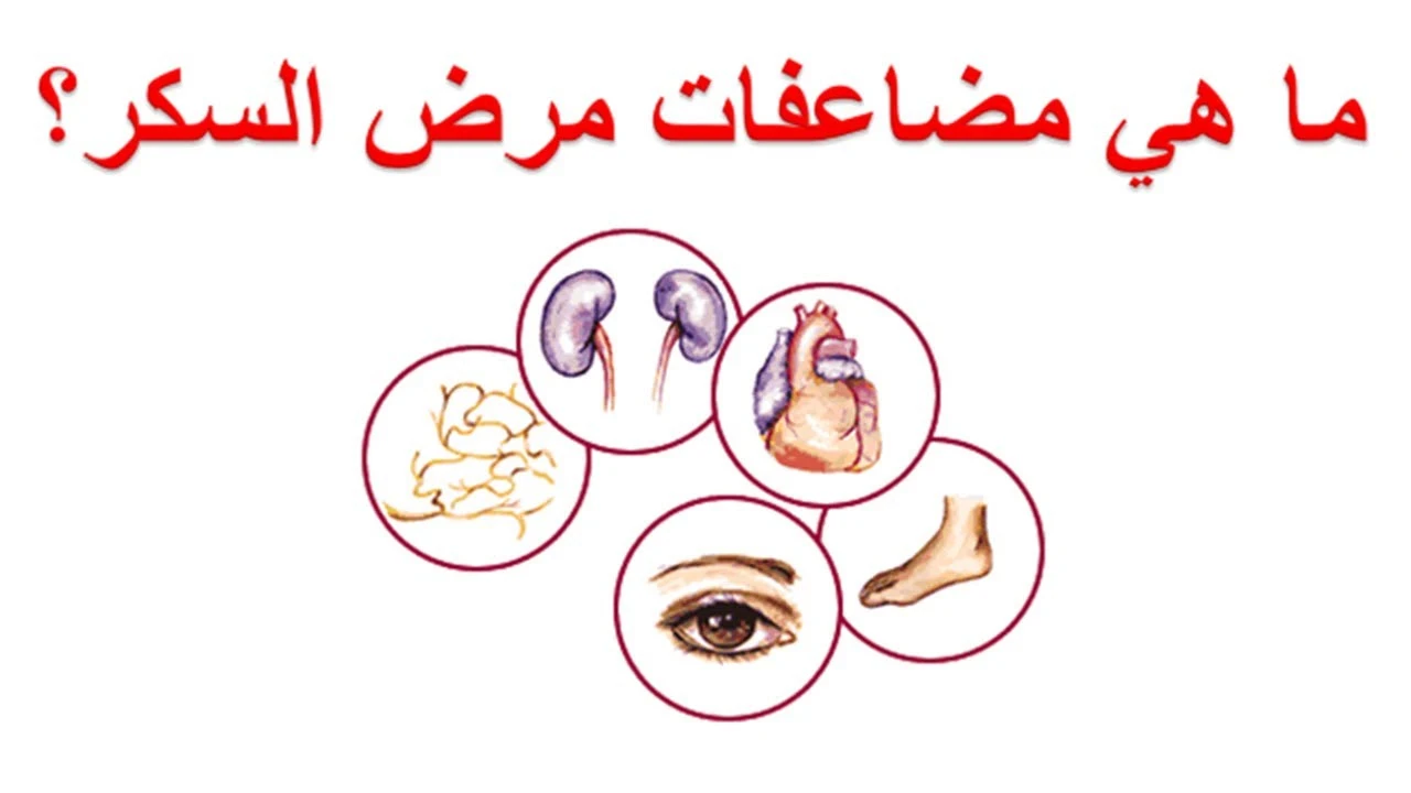 image about مضاعفات مرض السكري وكيفية الحد منها