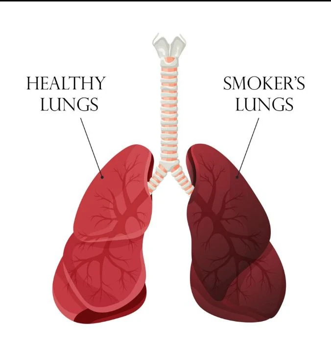 image about ابني المراهق والتدخين: كيف أحميه بالحوار والوعي؟