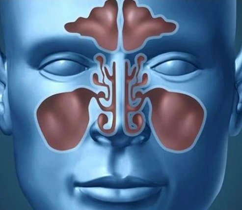 image about تنفس بحرية.. دليل مبسط لفهم التهاب الجيوب الأنفية وكيفية التغلب عليه بأساليب منزلية وطبية ناجحة