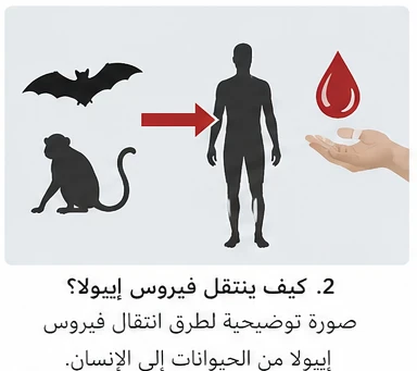 image about فيروس إيبولا: الأعراض والأسباب وطرق الوقاية والعلاج | أخطر الأمراض الفيروسية في العالم