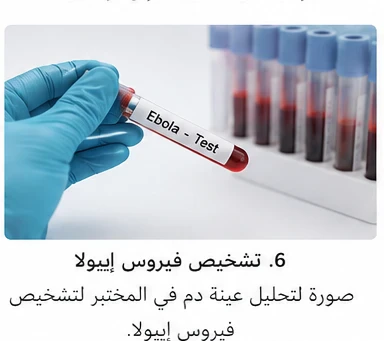 image about فيروس إيبولا: الأعراض والأسباب وطرق الوقاية والعلاج | أخطر الأمراض الفيروسية في العالم