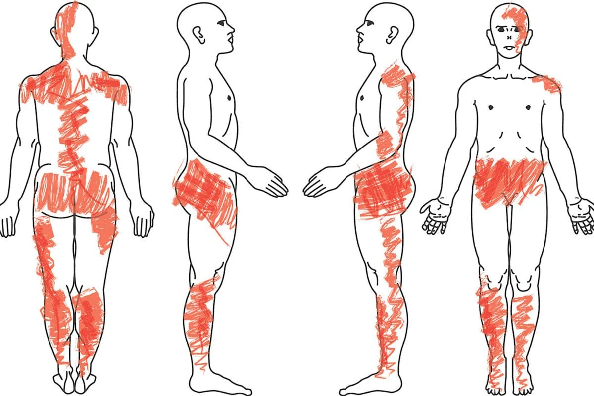 image about Fibromyalgia: Signs, Causes, Management, and Prevention A Complete Guide to Fibromyalgia 