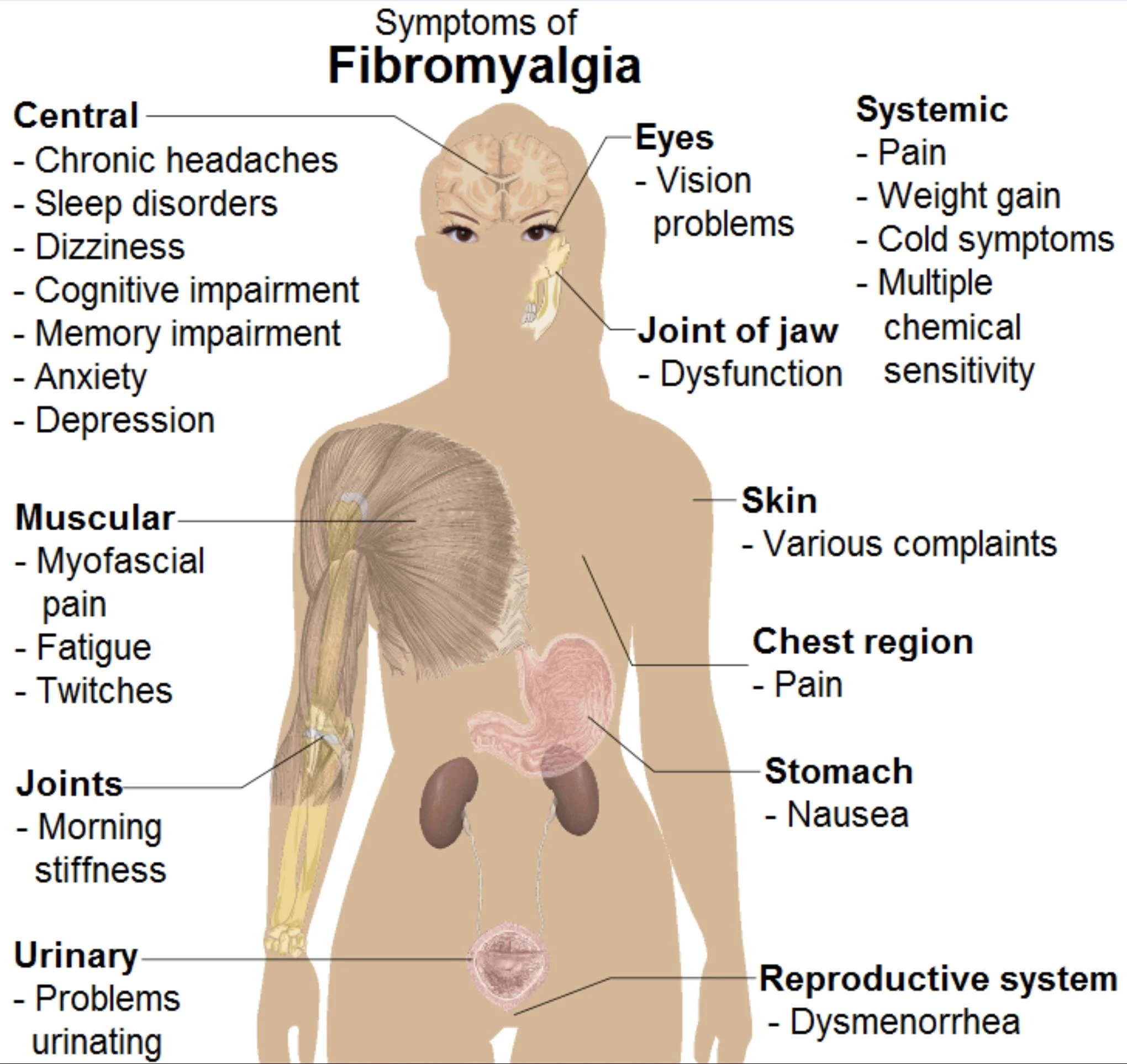 image about Fibromyalgia: Signs, Causes, Management, and Prevention A Complete Guide to Fibromyalgia 