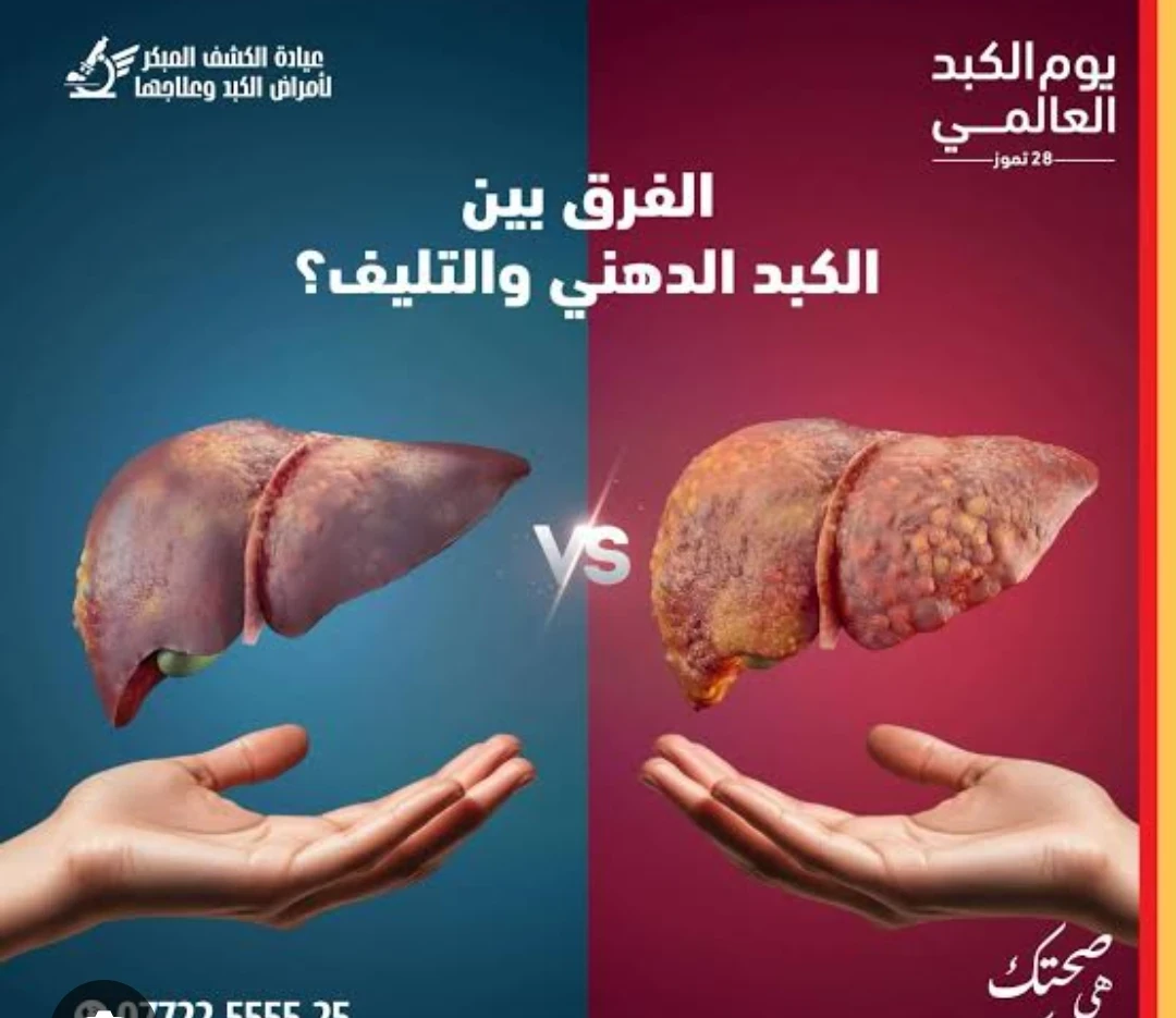 image about دهون الكبد: العدو الصامت.. كيف تتكون وكيف تستعيد كبدك؟