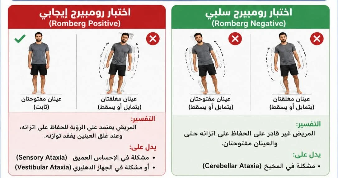 image about فقدان الاتزان Ataxia