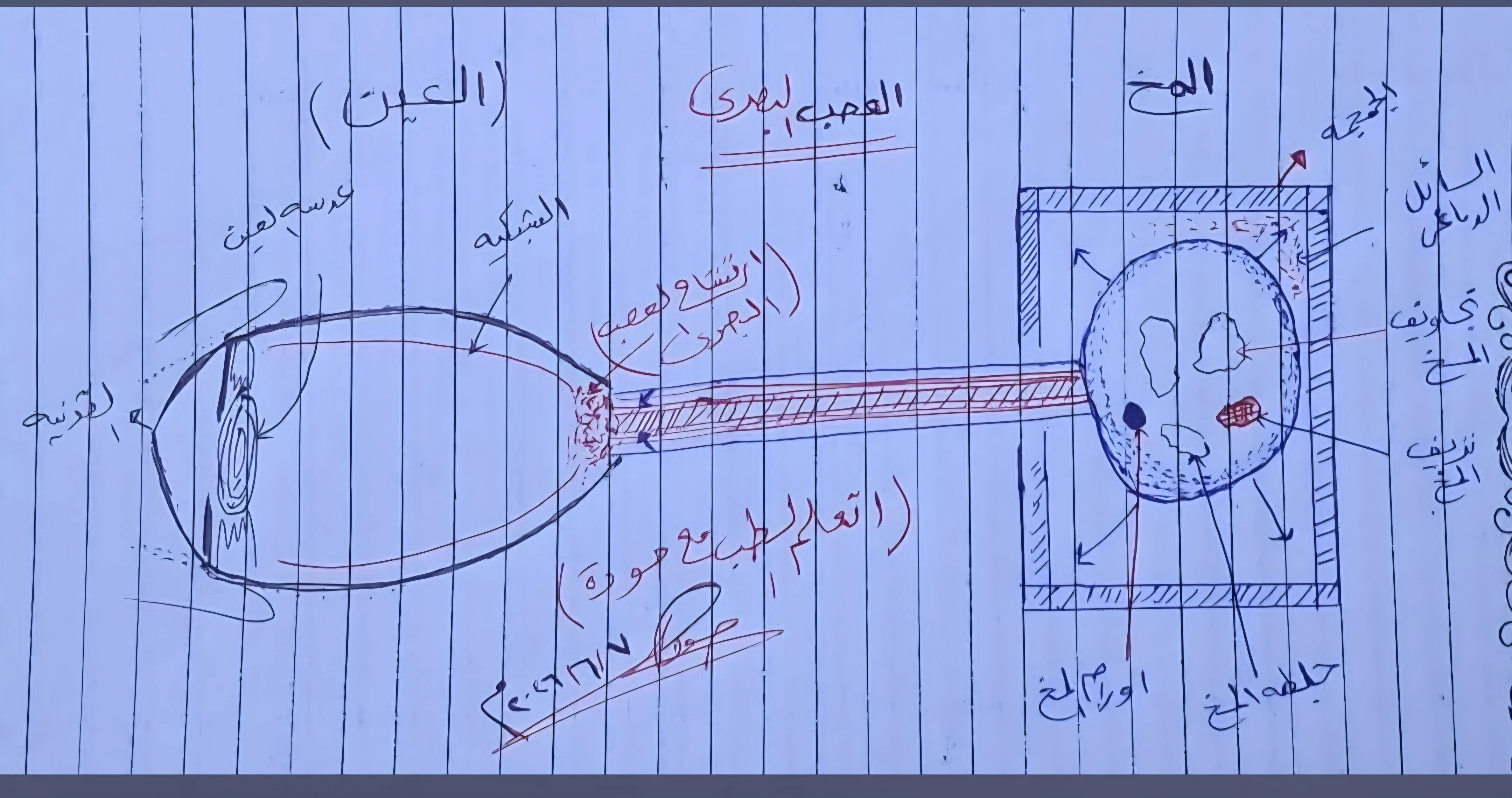 image about ارتشاح العصب البصري (Papilledema