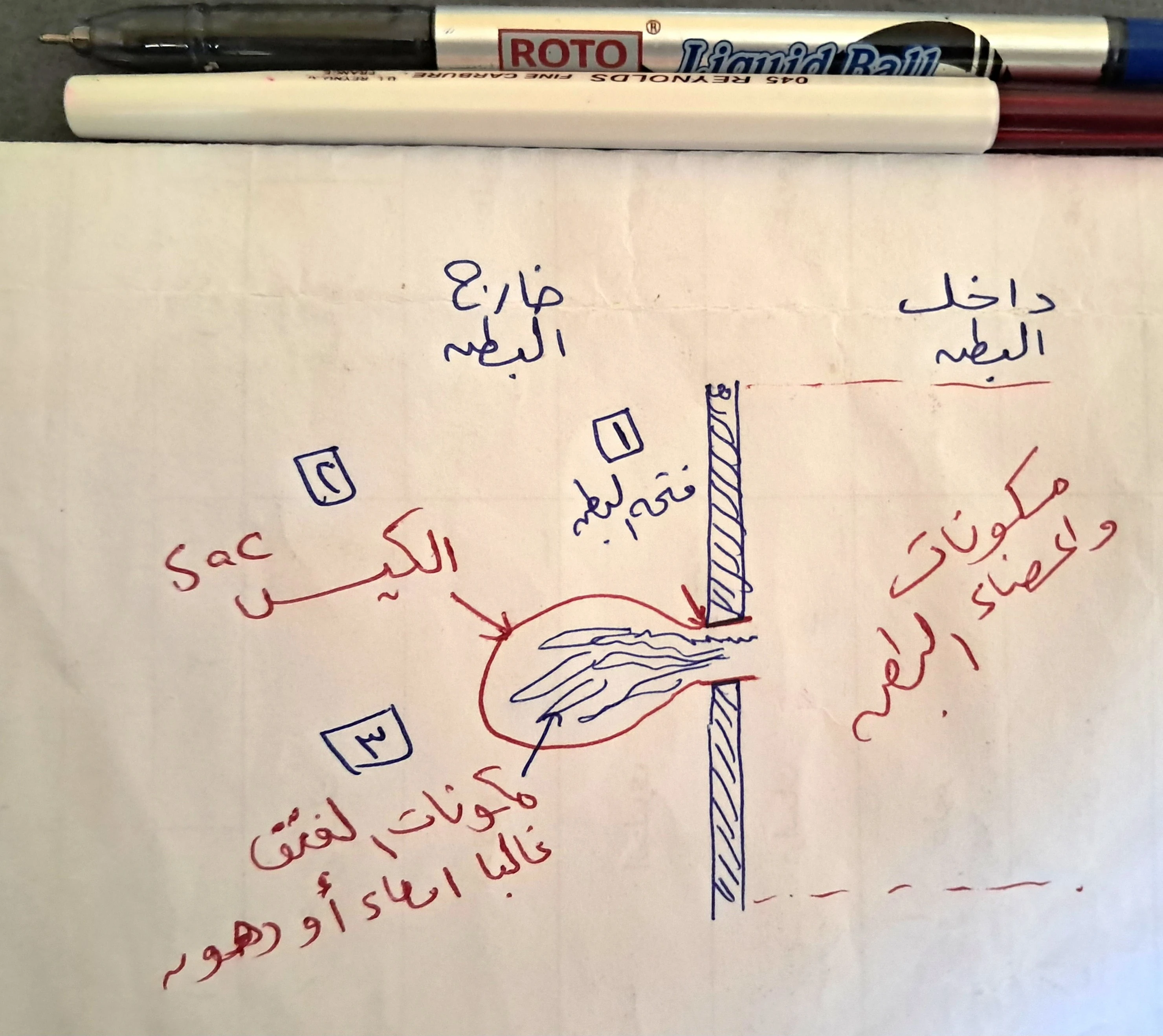 image about يعني إيه فتاق أو فتق أو عَرَق؟ Hernia