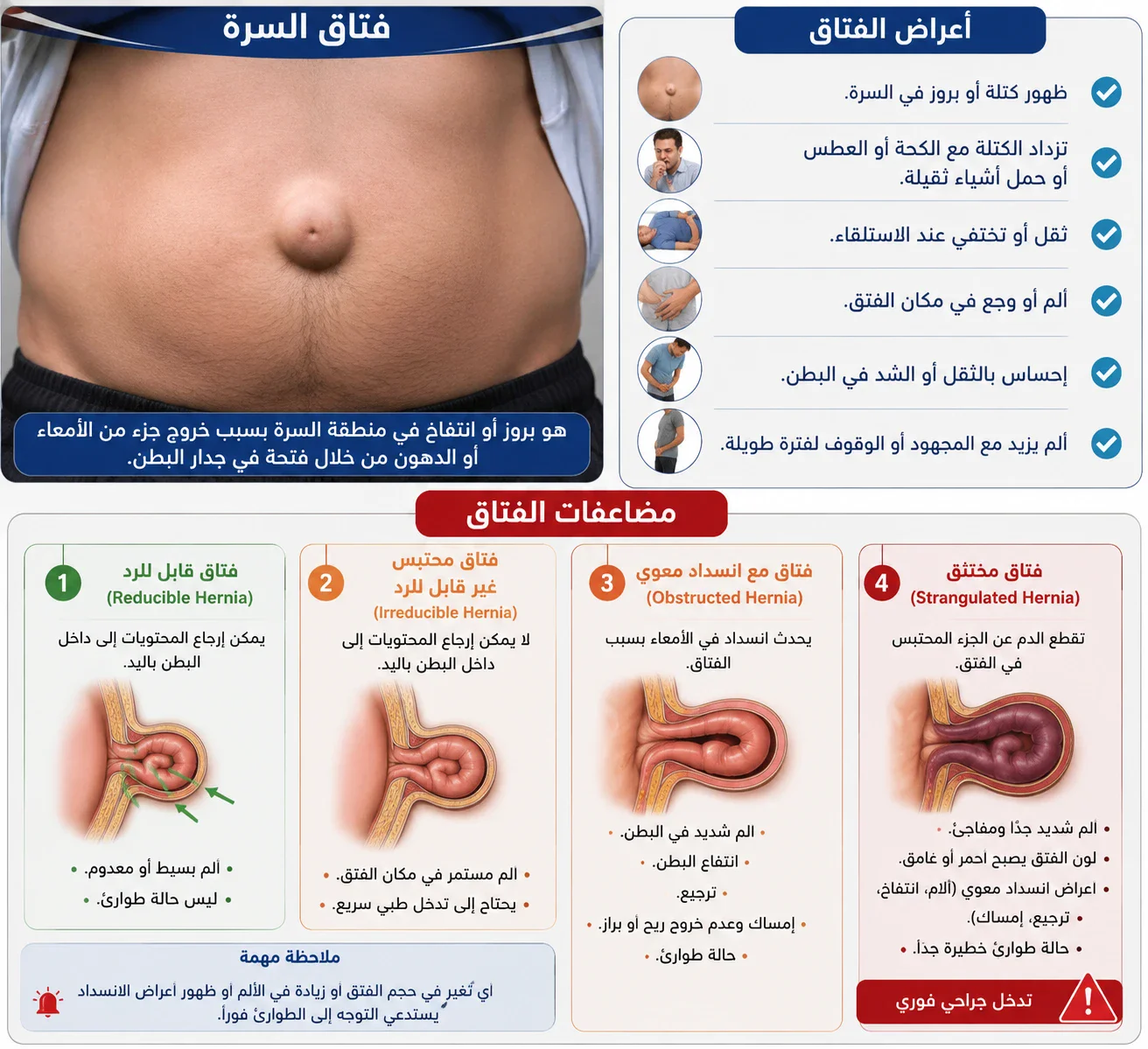 image about اعراض الفتاق ومضاعفاته وتشخيصه وعلاجه 