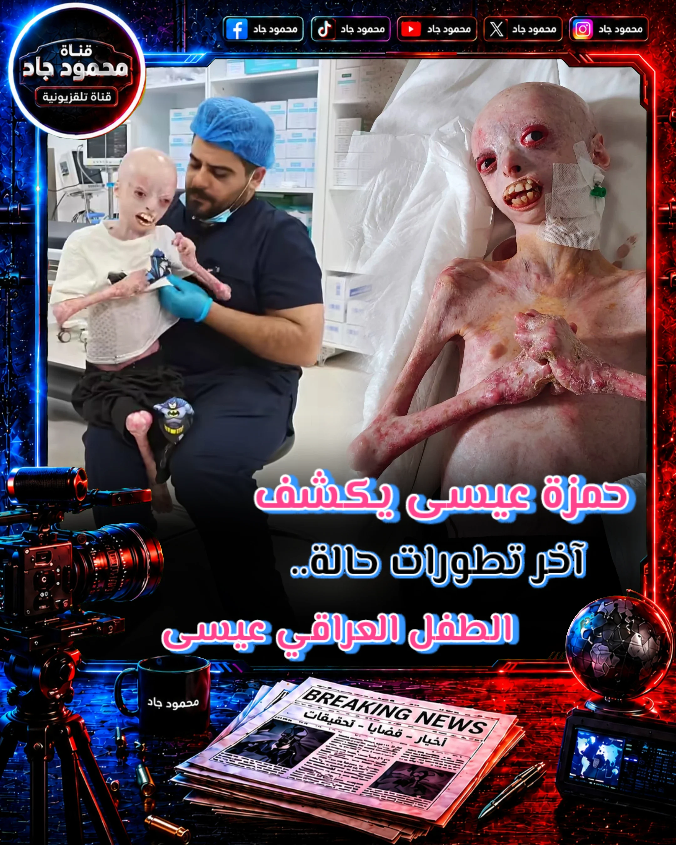 image about النتائج وصلت من ألمانيا.. ماذا ينتظر الطفل العراقي عيسى بعد أكثر من ثلاث سنوات من المعاناة؟