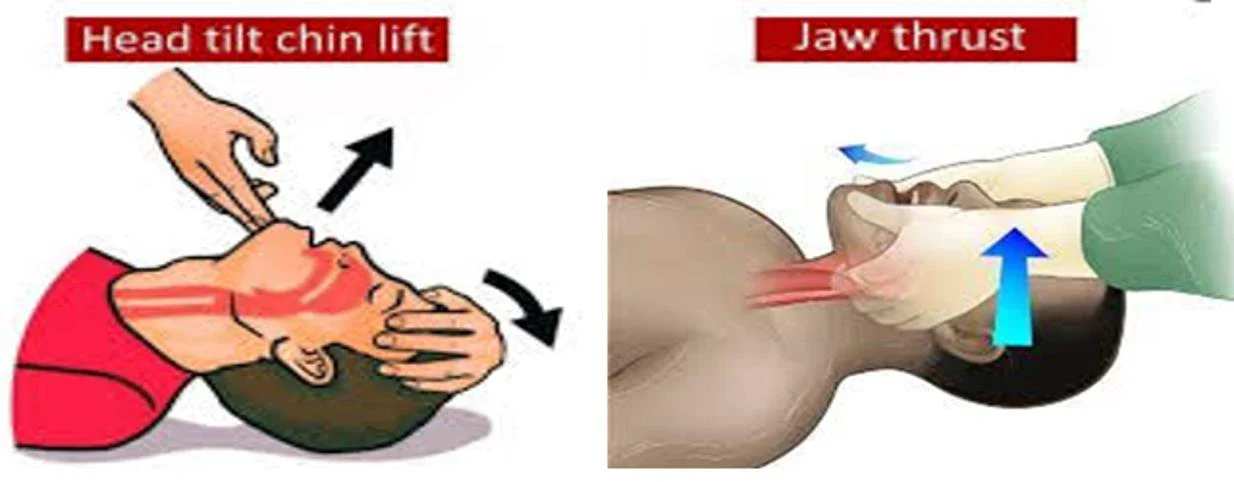 image about Adult basic life support