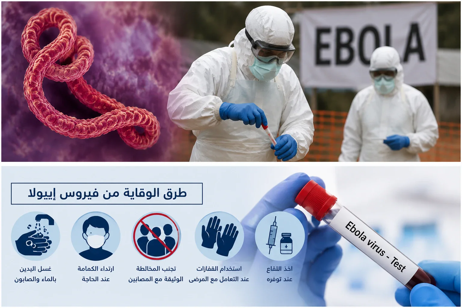 image about فيروس إيبولا الأعراض، طرق الانتقال، العلاج و الوقاية 