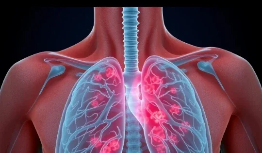 image about الالتهاب الرئوي: كيف تبدأ العدوى داخل الرئة وما أحدث طرق علاجه؟