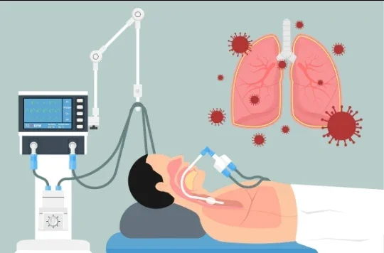 image about الالتهاب الرئوي: كيف تبدأ العدوى داخل الرئة وما أحدث طرق علاجه؟