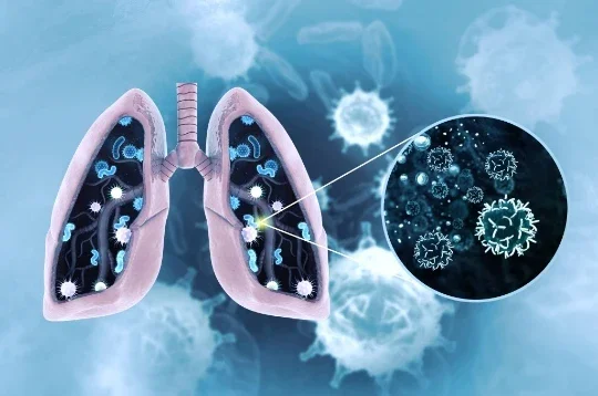 image about الالتهاب الرئوي: كيف تبدأ العدوى داخل الرئة وما أحدث طرق علاجه؟