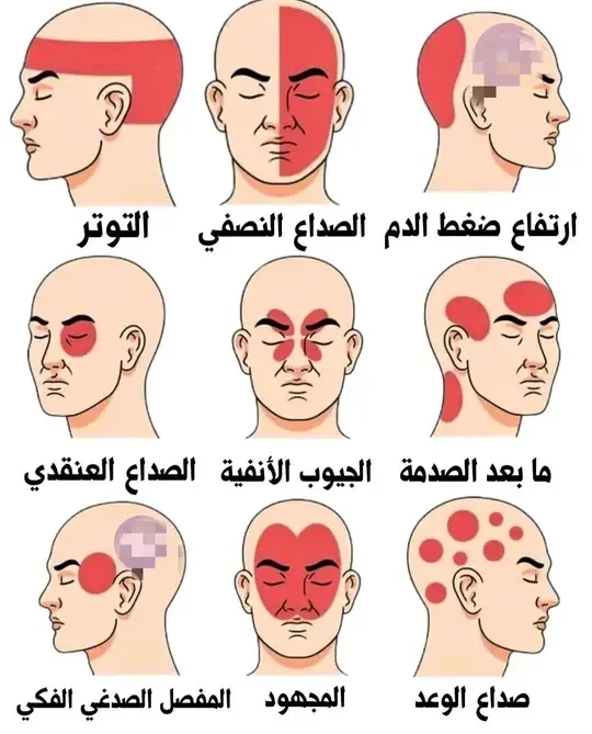 image about الصداع الذي لا يشبه صداعك: متى يتحول الألم إلى إنذار طبي؟