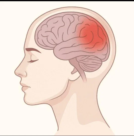 image about ماذا يخبرك الصداع النصفي في الجانب الأيمن؟