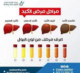 image about عندما يتقدم التليف