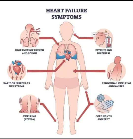 image about Shortness of Breath and Heart Disease: When Should You Be Concerned?
