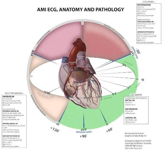 image about Coronary Artery Disease: How It Develops and Its Symptoms