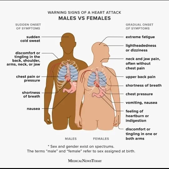 image about Heart Attack: Symptoms, Causes, and When It Becomes an Emergency