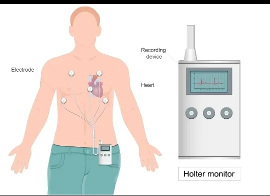 image about Cardiac Arrhythmia: Types, Symptoms, and Diagnostic Methods