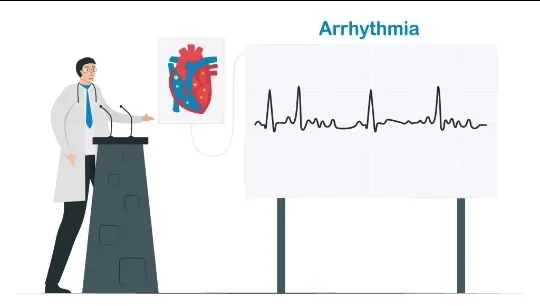 image about Cardiac Arrhythmia: Types, Symptoms, and Diagnostic Methods