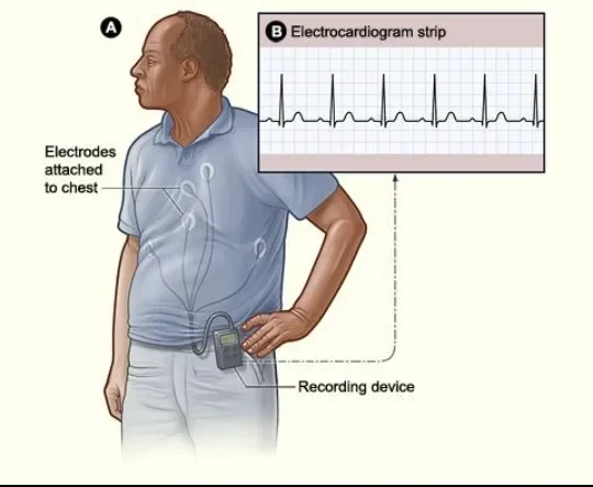 image about Cardiac Arrhythmia: Types, Symptoms, and Diagnostic Methods
