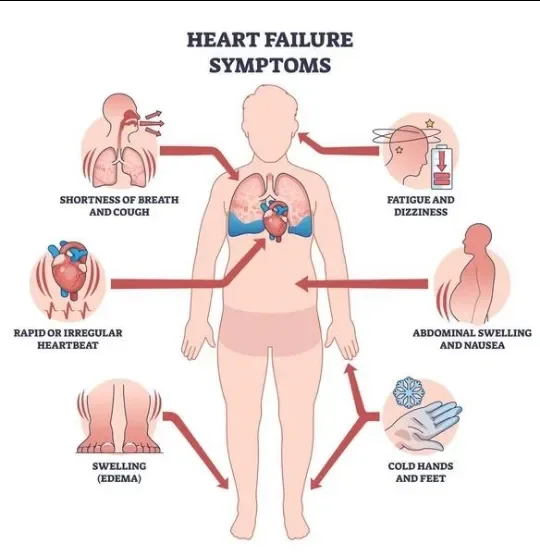 image about اعتلال عضلة القلب: الأنواع والأسباب وتأثيره على صحة القلب