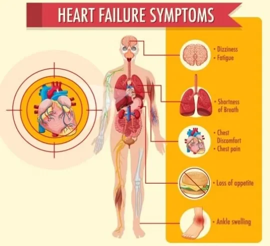 image about Can Heart Deterioration Be Halted Before Reaching a Critical Stage? What Modern Treatments Say