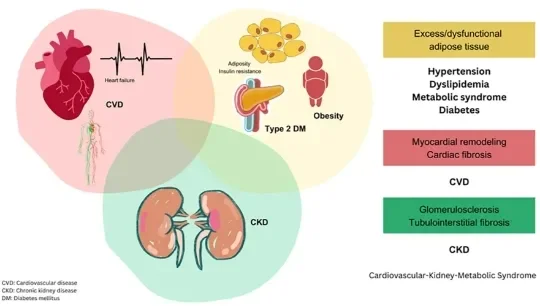 image about Cardiac treatment enters a new phase: Why do medications no longer target only blood pressure and heart rate?
