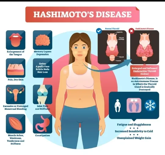 image about Thyroid Disorders, Weight Changes, and Pulse Irregularities: How Symptoms Overlap and Causes Differ