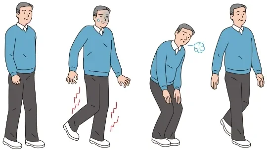 image about تفصيل صغير في طريقة مشيك قد يغير الأسئلة التي يطرحها طبيب القلب