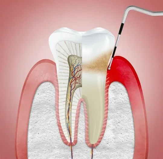 image about نزيف اللثة ليس أمرًا عابرًا.. ما العلاقة الخفية بين صحة الفم وأمراض القلب؟