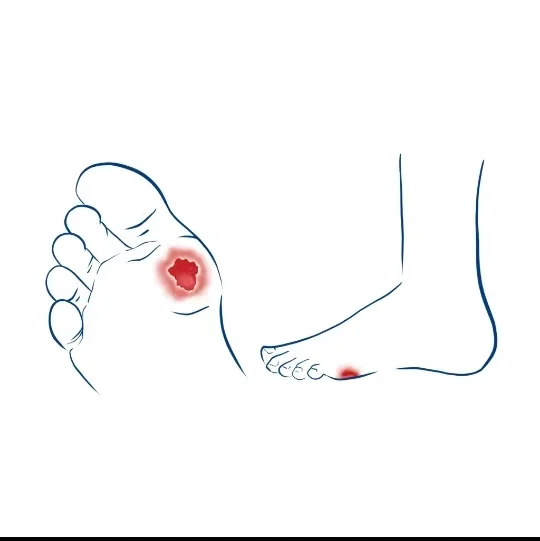 image about هل تكشف أظافرك ولون جلد قدميك عن مشكلة في الدورة الدموية؟