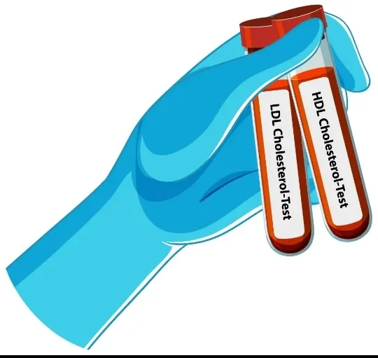 image about أهم الأسئلة حول الكوليسترول الضار: ما الذي يحدث داخل الشرايين دون أن نشعر؟