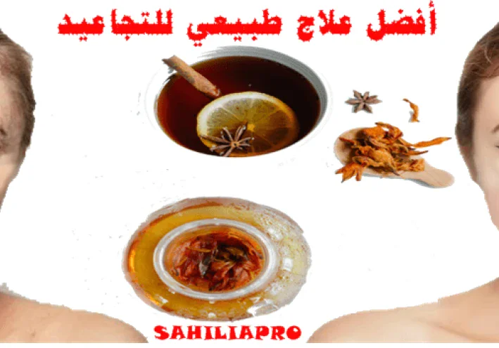 افضل علاج طبيعي للتجاعيد الوجه نهائياً