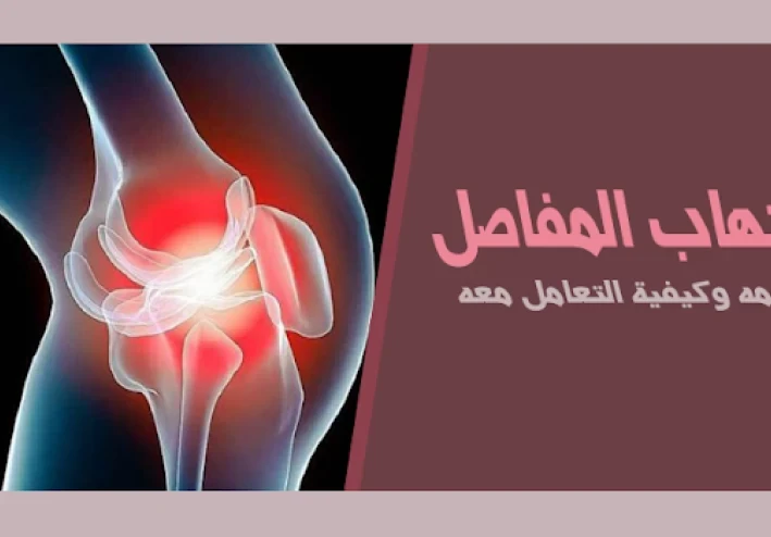 التهاب المفاصل: التعريف والأعراض والعلاج