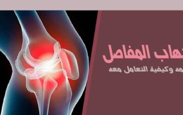 التهاب المفاصل: التعريف والأعراض والعلاج