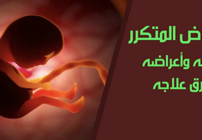 الإجهاض المتكرر: التعريف والأسباب والأعراض وطرق العلاج الطبي