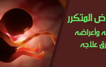 الإجهاض المتكرر: التعريف والأسباب والأعراض وطرق العلاج الطبي