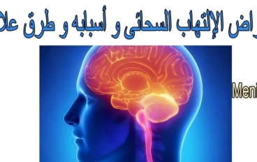 الالتهاب السحائى ( الحمى الشوكية ) 